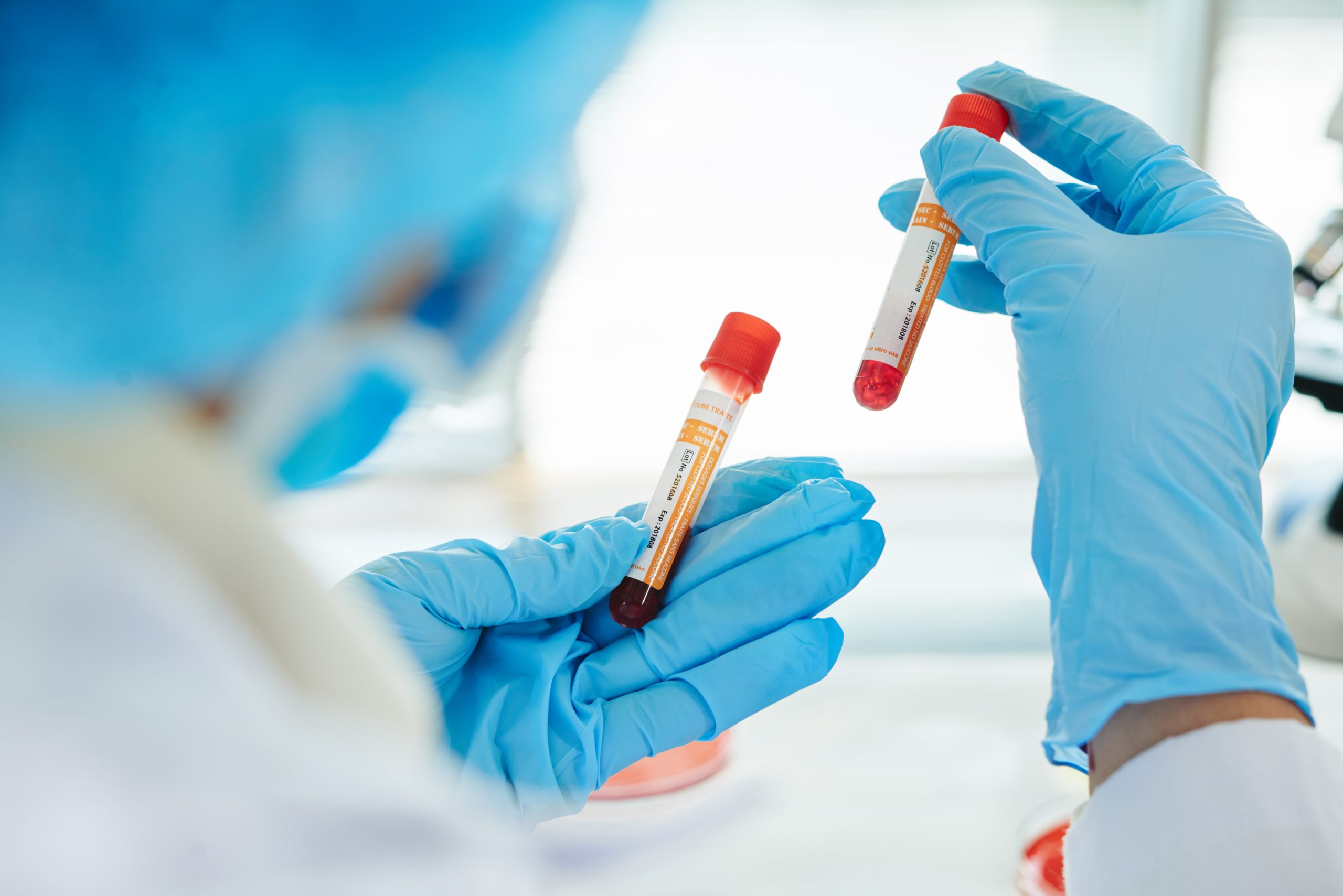 Close-up shot of unrecognizable doctor wearing rubber gloves and white coat holding blood test tubes in hands while wrapped up in work at modern lab
